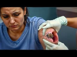 Old woman has a bug on her shoulder when doctors see it they called the officials