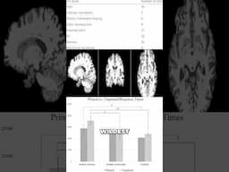 Savant Syndrome Within ALL of Us #mentalism #savant #autism #autistic #telepathy #mind #brain
