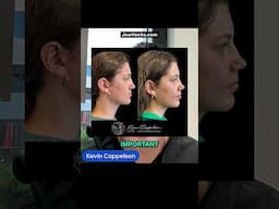 The surgery that can change your life