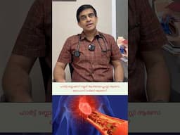 ഹാർട്ട്‌ ബ്ലോക്കിന് നല്ലത് ആൻജിയോപ്ലാസ്റ്റി ആണോ ബൈപാസ് സർജറി ആണോ?  #shortsfeed #shorts #shortvideo