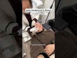 Collab || 3 MONTHS of acne treatments done #korea