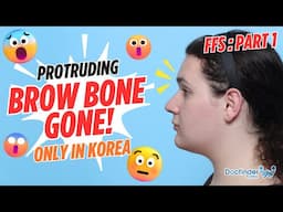 Facial Feminization Surgery in Korea: Dream Come True or Regret? P1. | Male to Female Transformation