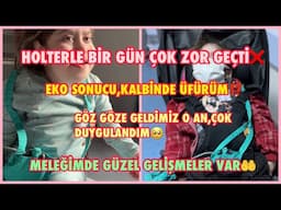 HOLTERLE BİR GÜN ZOR GEÇTİ❌EKO SONUCU,ÜFÜRÜM⁉️GÖZ GÖZE GELDİĞİMİZ AN,ÇOK DUYGULANDIM🥺GELİŞMELER VAR🤲