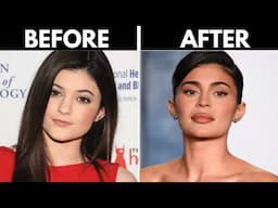 Your Botox Is Not Aging Well