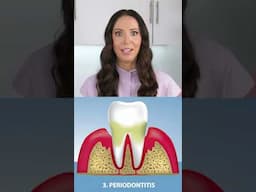 do teeth need scalings at the dentist? #shorts