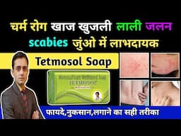 Tetmosol soap / चर्म रोग खाज खुजली Scabies जुंओ में लाभदायक