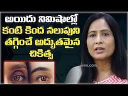 నిమిషాల్లో కంటి కింద నలుపుని తగ్గించే చికిత్స |👌🔥Dark Circles Treatment EXPERT Shares Shocking Trut