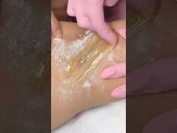 SUGARING | SUGAR WAX #waxing #sugarwaxing #sugaring #hairremoval