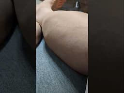 visible leg vein!