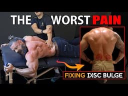 The WORST PAIN! Fix Hidden BULGING DISC Pain & Avoid Surgery (DON'T IGNORE THESE SYMPTOMS!)
