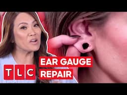Dr. Sanrda Lee Repairs A STRETCHED Earlobe After Gauging | Dr. Pimple Popper: This Is Zit