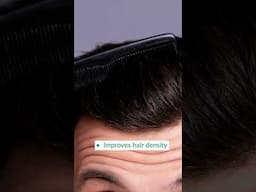 Hair Fall & Thinning Due to DHT? Here’s How It Happens! 🧑‍⚕️💊