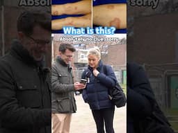Doctor explains Granuloma Annulare #shorts