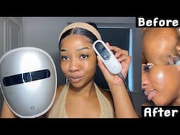 AMIRO 5 in 1 LED FACE MASK REVIEW: My secret to a FAST GLOW UP 😍