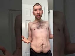 Revealing my Loose Skin after Weight Loss