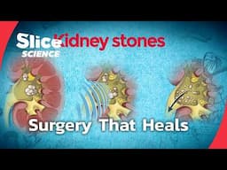 Breakthroughs in Urology & Pulmonology | SLICE SCIENCE