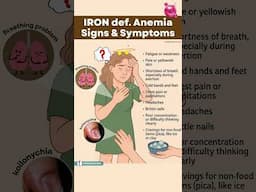 Don't Ignore These IRON DEFICIENCY Anemia Warning Signs