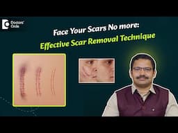 Accidental Scar Treatment on Face | Surgical Scar | - Dr  Deepak P Devakar | Doctors' Circle