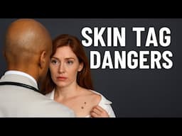 What You Need To Know About Skin Tags