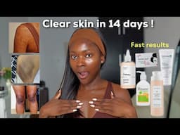 My Skin Cleared in 14 Days Using this BODY ROUTINE ! | Effective body routine for hyperpigmentation