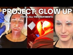 Project Glow Up 2025 Pt 2 | Getting ALL the face treatments