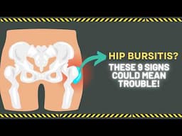 9 Warning Signs of Hip Bursitis You Must Know