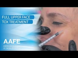 Full Upper Face Tox Treatment