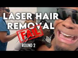 Laser Hair Removal Lady Almost BANNED Me After This