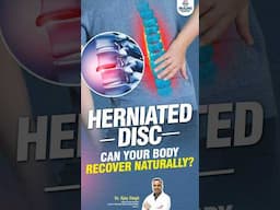 Is Surgery Always Needed for Herniated Disc? | Natural Recovery Explained