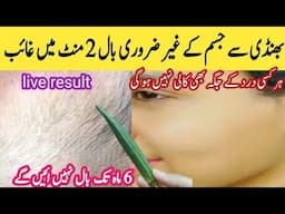 Without hair removal Cream removed your beard & mustache surprised 😱||facial hair removal remedy