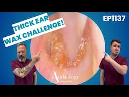 Multiple Ear Wax Removals: Thick Ear Wax Plugs, Jaw Pain & Surprising Finds! 👂😳 - EP1137