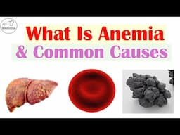 What is Anemia and How to Easily Find Out The Cause