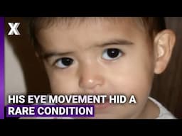 Diagnosed With Fourth Nerve Palsy at Two