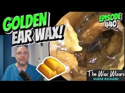 GOLDEN EAR WAX! Episode 440 (and the 'goldilocks wax, & the tiniest ears!)