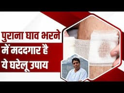 पुराना घाव (Wounds) भरने में मददगार है ये घरेलू उपाय || Acharya Balkrishna