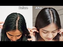 Say Bye-Bye to Oily Scalp with the New Launch by L’Oréal Paris i.e Hyaluron Pure Range!