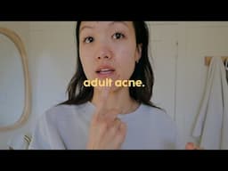 the ongoing struggle with adult acne, procrastination, and self-confidence