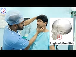 Jawline surgery in mumbai Delhi ahmedabad kolkata Bangalore Hyderabad chandigarh Kochi Lucknow