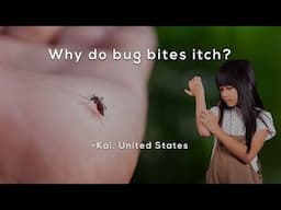Why do bug bites itch?