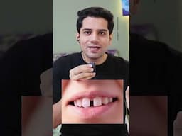 Daanto me gap hai? #shivammalik
