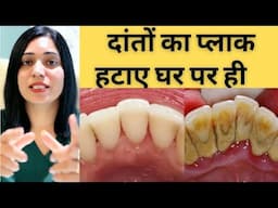 दांतों से प्लाक  हटाने के घरेलू तरीके | Home Remedy For Dental plaque |