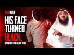 His Face Turned Black, This Is Why | EP30 | Stories Of Dead People Series